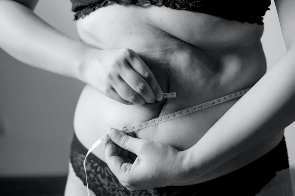 PCOS and Obesity: How Weight Affects Symptoms and What Helps