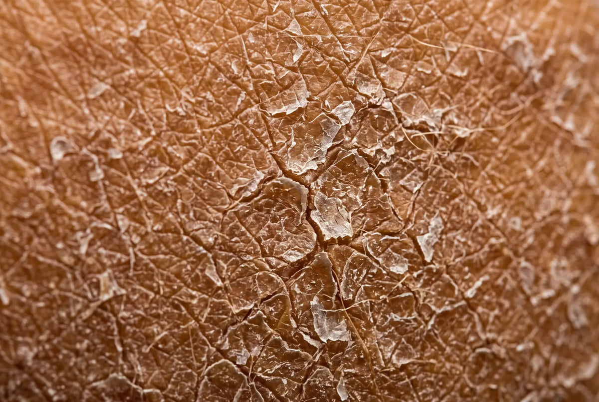 GHK-Cu protocol for dry skin