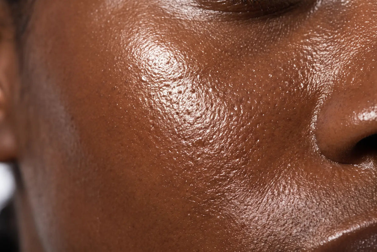 Skin profile for combination and oily skin